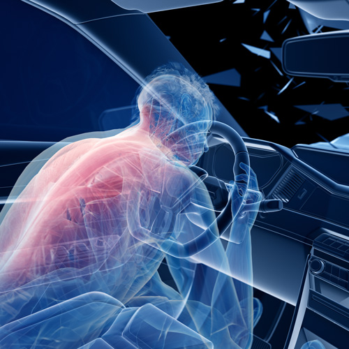 Chiropractic Care and Car Accident Recovery - What Happens to the Body After an Accident