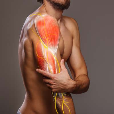 Understanding Nerve Pain and How Chiropractic Care Can Help