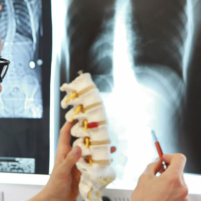 Understanding Corrective Care Chiropractic