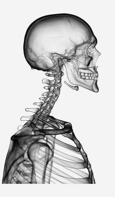 cervical-spine-xray-posture-assessment-irvine Lateral X-ray of the cervical spine showing forward head posture, used by chiropractors at Zen Care Irvine to diagnose spinal misalignment.