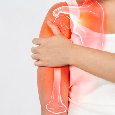 Rotator Cuff Injuries Chiropractor